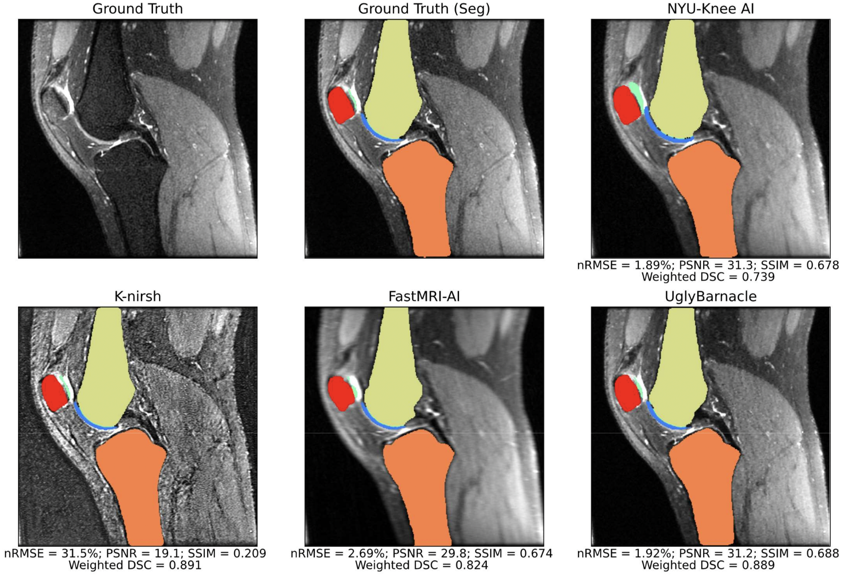 K2S Challenge: From Undersampled K-Space to Automatic Segmentation